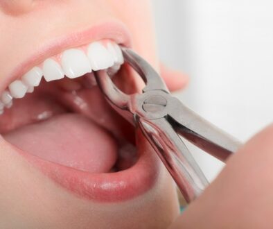 tooth_extraction__1586381681_66121
