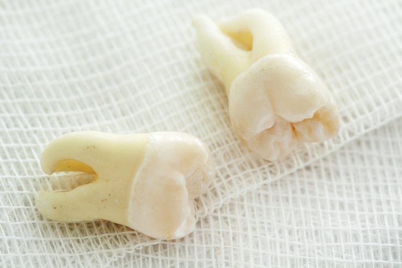 RECOVERING FROM A WISDOM TOOTH EXTRACTION- THINGS TO KNOW